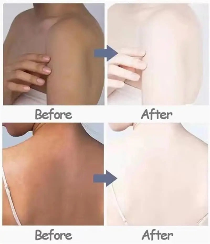 Body Whitening Cream Private Parts Underarm Legs Knee Bleach Lotion Inner Thigh Intimate Dark Remove Melanin Brighten Skin Care