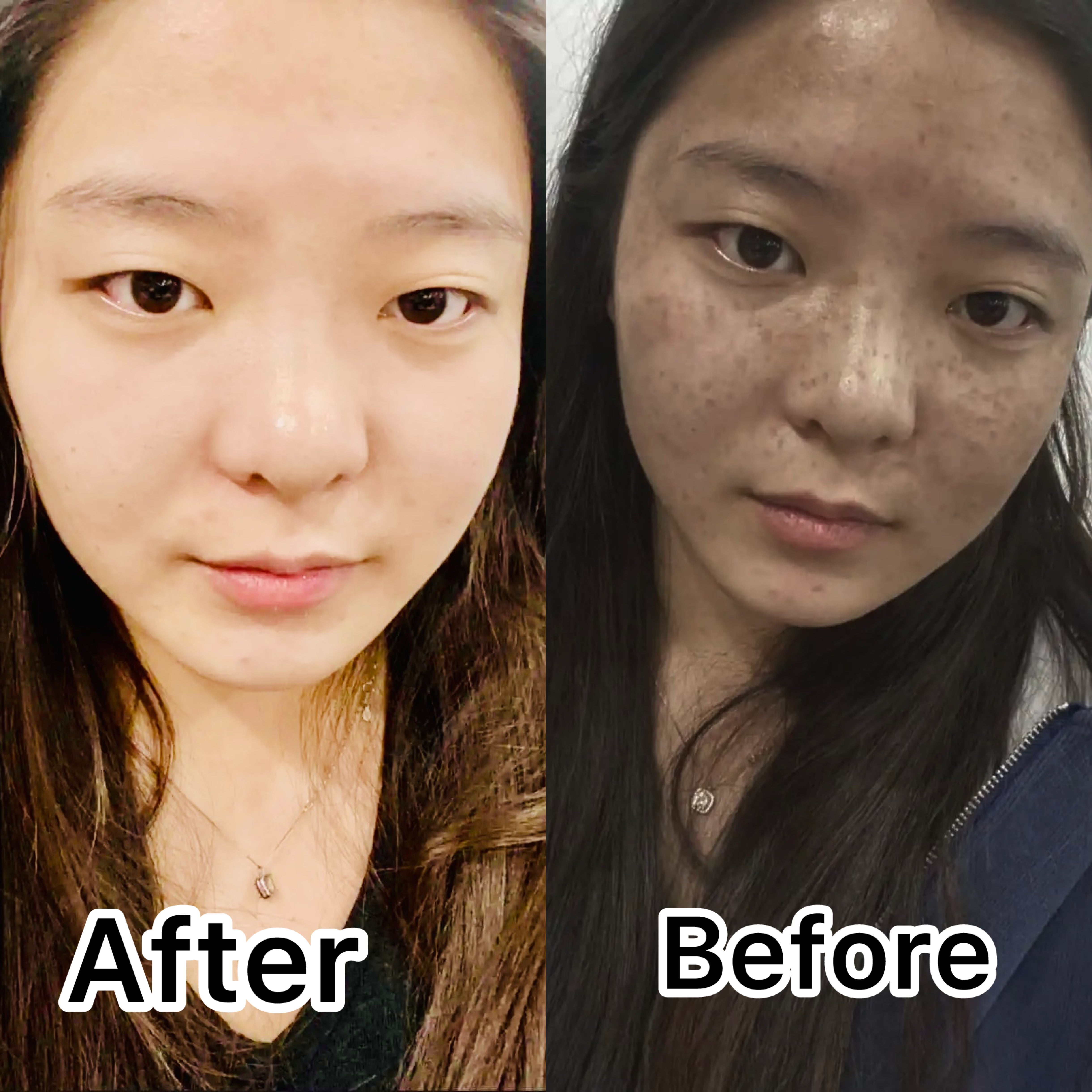 Body Whitening Cream Private Parts Underarm Legs Knee Bleach Lotion Inner Thigh Intimate Dark Remove Melanin Brighten Skin Care