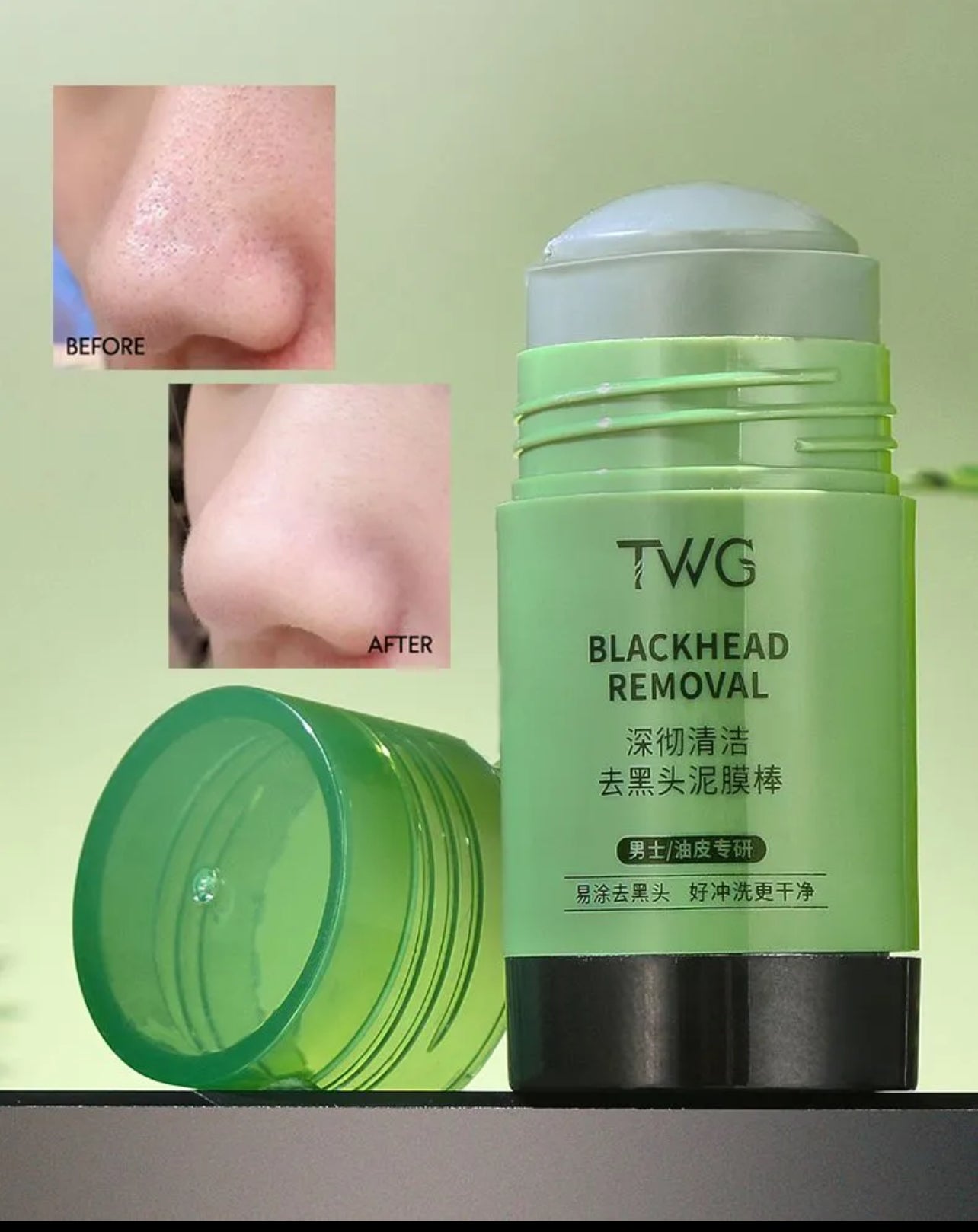 KOREAN ACNE STICK